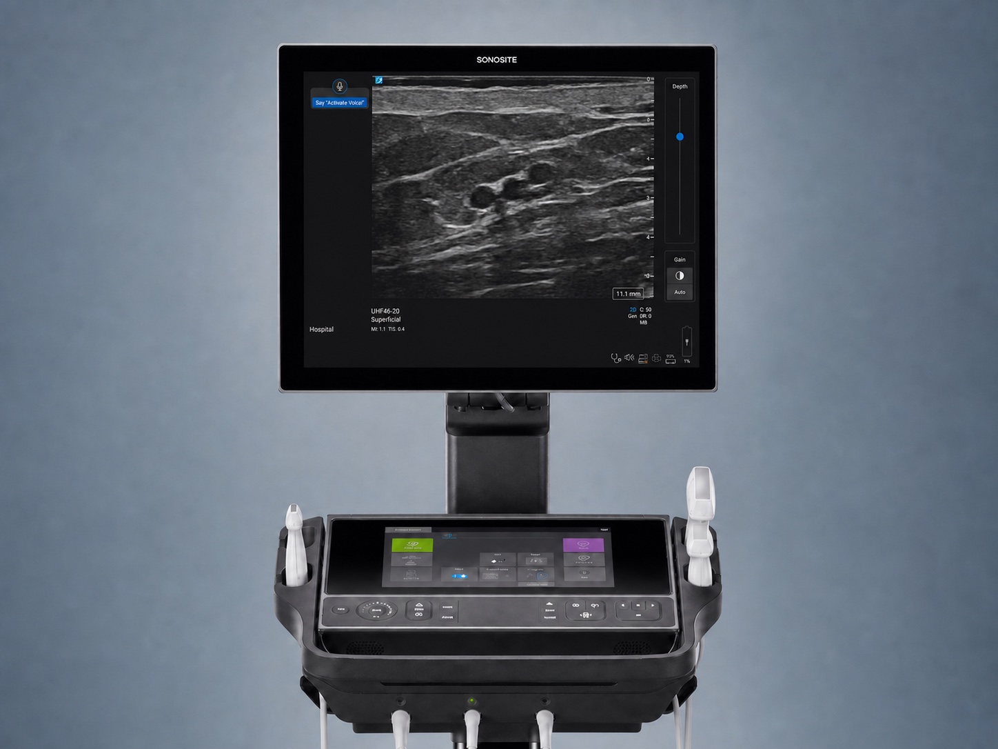 AI-edited ultrasound imaging system displaying a superficial ultra-high-frequency ultrasound image